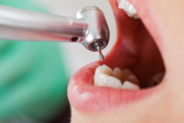 Best Emergency Treatment for Toothache in Del Rio, CA